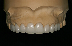 Full restoration example
