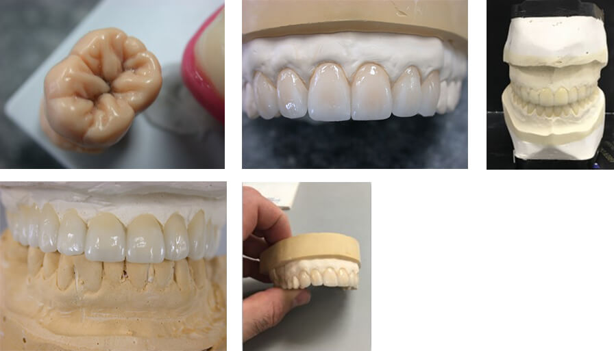 Silva Dental Lab custom shades room